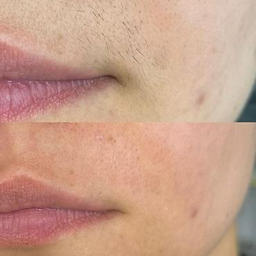 Эпиляция: ТОЛЬКО ДЛЯ ЖЕНЩИН Шугаринг и восковая депиляция Услуга — 6