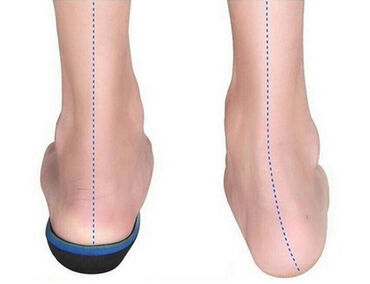 Другая мужская обувь: Стельки ортопедические(специализированные) от плоскостопия! Для — 24