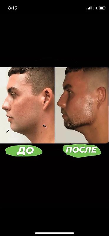 скулер: Эспандер для скулы ( жаак чыгарыш учун ) Ош шаарында доставка бекер — 2