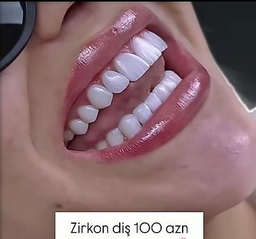 diş: Xidmət: Zirkon diş Təsvir: - Estetik və möhkəm zirkon bərpalar – — 1