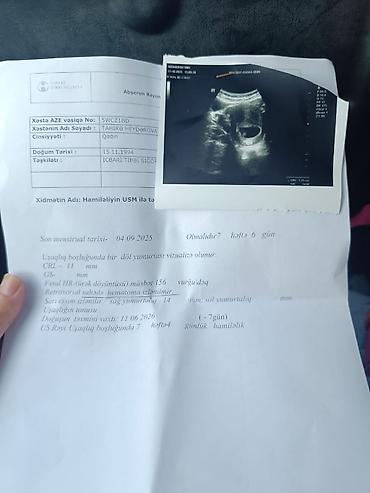 Gəzinti arabaları: Kolyaska deridi İdeal veziyyetde 100 azn Oturaqli da olur Sulutepe — 2