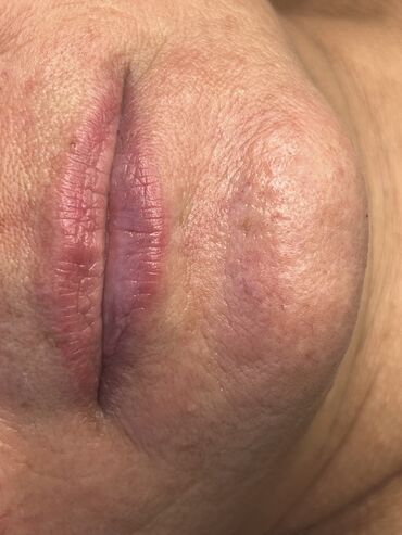 Косметология: Косметология, Ботокс, Биоревитализация, Ботулинотерапия, Консультация, Гипоаллергенные материалы, Сертифицированный косметолог — 4