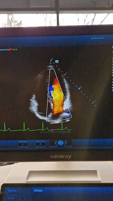 Медицинское оборудование: Продаётся УЗИ аппарат экспертного класса Mindray DC-80 X-INSIGHT — 5