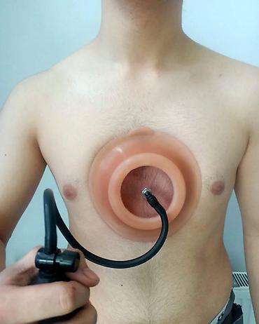 vapur 10000: Biz Türkiye de "vacuum bell" alet istesal edirik . Azərbaycanda — 4