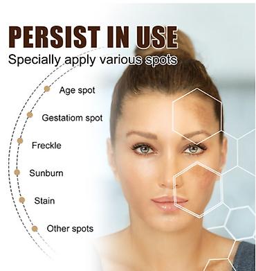 Уход за телом: США Крем интенсивное отбеливание удаление темных пятен веснушек и — 4