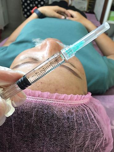 Косметология: Косметология, Ботокс, Биоревитализация, Ботулинотерапия, С выездом на дом, Консультация, Гипоаллергенные материалы — 18