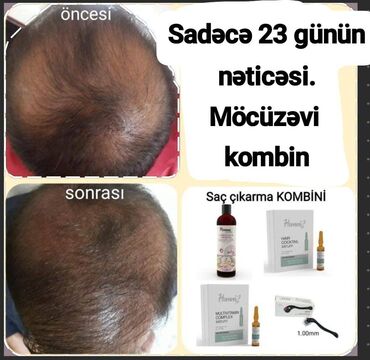 ketoconazol şampun: Saç şampunu, Yeni, Pulsuz çatdırılma, Rayonlara çatdırılma