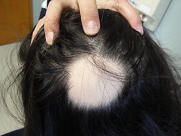 етор: Сыворотка для роста волос и бороды REAXIDIL 10% Minoxidil, 50 мл - — 6