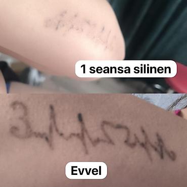 doyme sekilleri: Tatunuzun seklin gonderin qiymet deyilsin🤗3 seansa kimi lyuboy seansda — 2