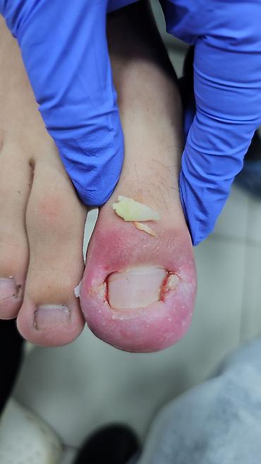 Маникюр: Коррекция вросших ногтей, Маникюр, Педикюр, Услуги подолога, С выездом на дом, Консультация, Одноразовые расходные материалы — 10