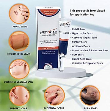 ожог: Снова в наличии MEDISCAR Silicone Scar Gel — медицинский силиконовый — 3
