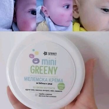 Nega kože: 🌿GREEN🌿 💚Mini Greeny - kolekcija za bebe i decu 💭 Dozvolite i vašem — 5