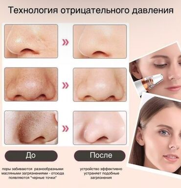 насадка для пениса: Вакуумный аппарат для чистки лица,носа и др с режимами скорости at lalafo.kg насадка для пениса: Вакуумный аппарат для чистки лица,носа и др с режимами скорости