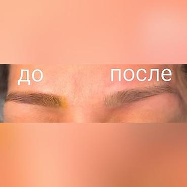 стоп кадр бишкек: Лазерное удаление перманентного макияжа и татуажа - Современная — 3