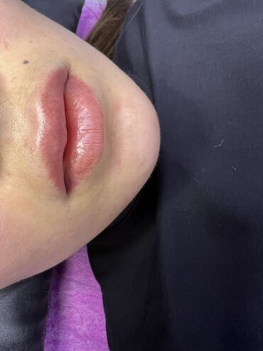 Косметология: Косметология, Ботокс, Биоревитализация, Ботулинотерапия, Консультация, Гипоаллергенные материалы, Сертифицированный косметолог — 22