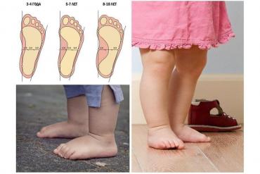 ортопедическая обувь бишкек для взрослых: Стельки детские (лечебные и профилактические) Стельки