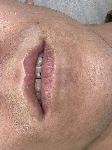 Косметика: Процедура перманентного макияжа губ позволяет придать губам желаемый — 30