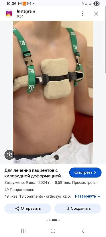 лампа витилиго: КУПЛЮ Б/У Ортопедический корректор для грудной клетки (килеобразная — 1