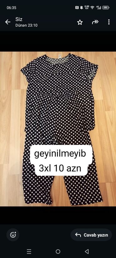 qadin pencekleri: İstəyən xanımlar yazsinlar