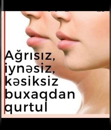 Avadanlığın icarəsi: Tecili!!! SATILIR VE YA ARENDAYA VERİLİR (AYLIQI 350 AZN)endirim — 10