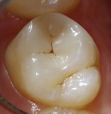 Stomatologiya: Stomatoloq Dr. Feyruz Dadaşovun fərdi praktikadasında böyüklərin və — 4