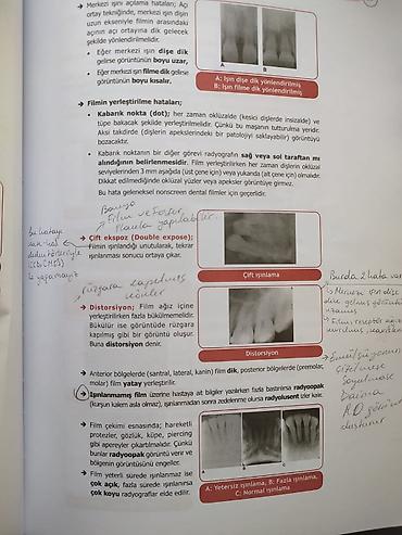 Tibbi avadanlıq: 🦷 DİŞ HƏKİMLƏRİ VƏ DİŞ HƏKİMLİYİ FAKÜLTƏSİ TƏLƏBƏLƏRİ ÜÇÜN! 🦷 📢 DUS-A — 3