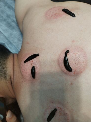 Hicama, zəli: İlk önce masaj hicama, zeli üzre bir mütexessis kimi onu deye bilerem — 7