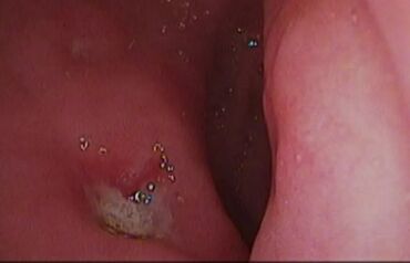 Другие услуги: ЭГДС. Гастроскопия . ФКС. +ТЮБАЖ. Осмотр желудка, кишечника. Врач — 6