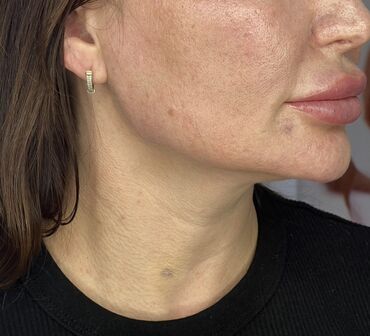 Косметика: Процедура перманентного макияжа губ позволяет придать губам желаемый — 13