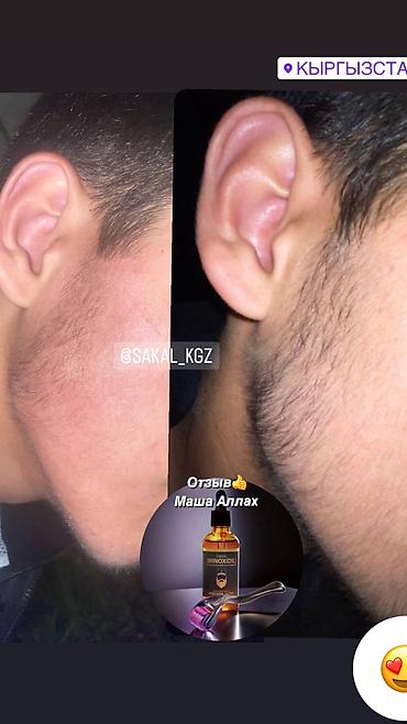 Уход за телом: Миноксидил ультра 15% 100мл 3 месяц хватает Для бороды и волосы — 2