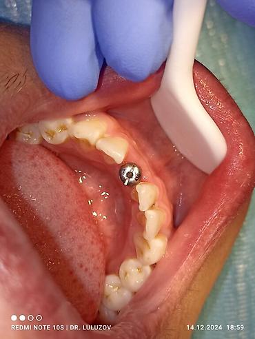 Медицинские услуги: Клиника | Стоматолог | Протезирование — 11