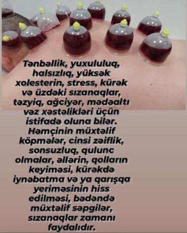 Hicama, zəli: Hicamanın Faydaları✅ *Qan dövranın pozulması *Qanın təmizlənməsi — 11