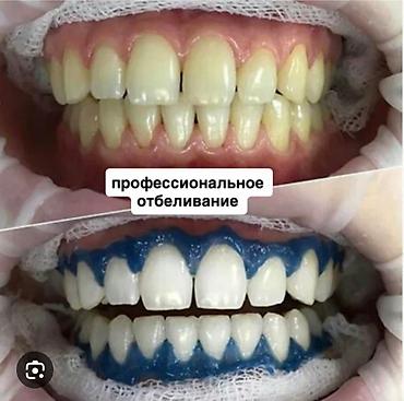 брекеты зубы: Клиника | Стоматолог | Протезирование — 3