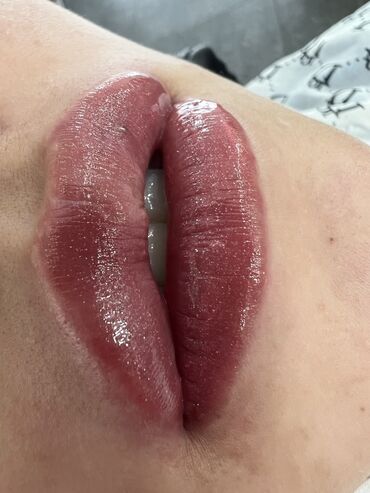 Косметология: Косметология, Маски, Мезотерапия, Удаление носогубных складок, Гипоаллергенные материалы, Консультация, Сертифицированный косметолог — 80