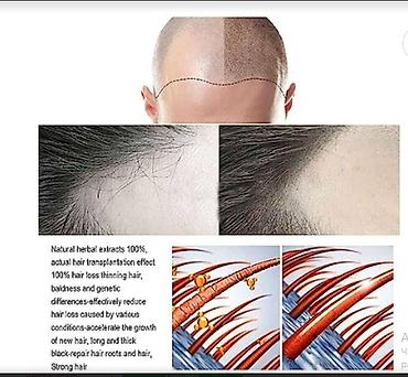 Уход за телом: США от выпадения для роста волос - вся инфа на фото оригинал прямые — 8