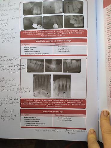 Tibbi avadanlıq: 🦷 DİŞ HƏKİMLƏRİ VƏ DİŞ HƏKİMLİYİ FAKÜLTƏSİ TƏLƏBƏLƏRİ ÜÇÜN! 🦷 📢 DUS-A — 2