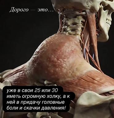 Массаж: Массаж | Лечебный массаж | Холка на шее | С выездом на дом, Консультация — 3