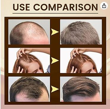 Уход за телом: ❄️ сша с аmazon сыворотка для лечения волос от выпадения волос от — 8