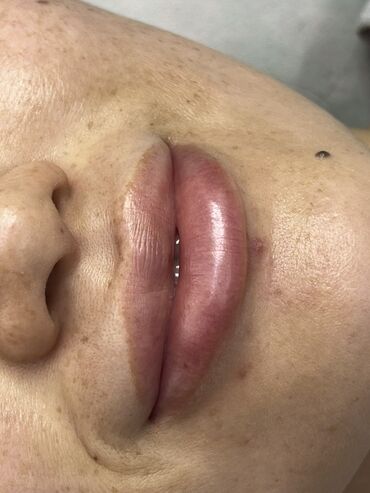 Косметика: Процедура перманентного макияжа губ позволяет придать губам желаемый — 15