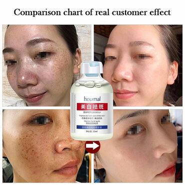 Косметика: От пигментации От пигментных пятен От веснушек Эссенция, поглощающая — 4