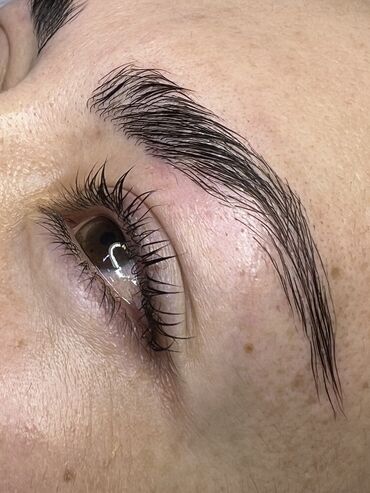 Косметология: Косметология, Биоревитализация, Ботокс, Демодекоз, Гипоаллергенные материалы, Консультация, Сертифицированный косметолог — 17