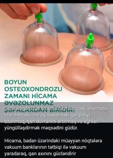 услуги по уходу за больными на дому: Xidmət: Hicama, hirudoterapiya və masaj - Hicama terapiyası: Bədənin