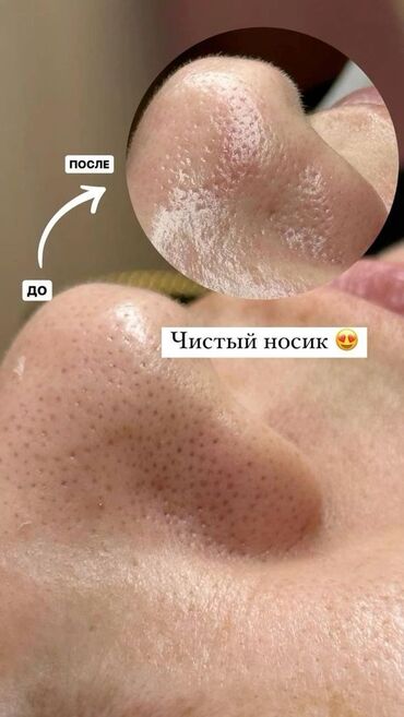 Косметология: Косметология, Пилинг, Ботулинотерапия, Плазмолифтинг, Консультация, Требуются модели, Сертифицированный косметолог — 11