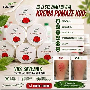 Nega kože: Ide leto,deca su u majicama i sorcicima. Padovi sa — 1