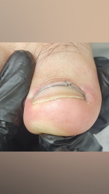 Маникюр, педикюр: Коррекция вросших ногтей, Маникюр, Педикюр, Услуги подолога, Консультация, Одноразовые расходные материалы — 6