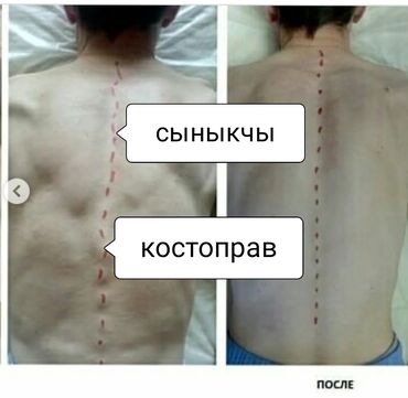 крем для депиляции для мужчин бишкек в Кыргызстан | КОСМЕТИКА: Массаж | Медовый, Лечебный, Другой вид массажа | Консультация