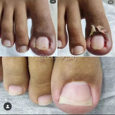 Маникюр, педикюр: Выравнивание, Наращивание ногтей, Донаращивание ногтей, Маникюр, Педикюр, Услуги подолога, С выездом на дом, Консультация, Одноразовые расходные материалы at lalafo.kg — 8 Маникюр, педикюр: Выравнивание, Наращивание ногтей, Донаращивание ногтей, Маникюр, Педикюр, Услуги подолога, С выездом на дом, Консультация, Одноразовые расходные материалы — 8