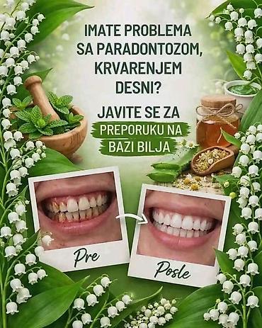 Ortopedski dušeci i jastuci: Limes proizvodi Porudzbine,saradnja postani moj kupac,saradnik — 102