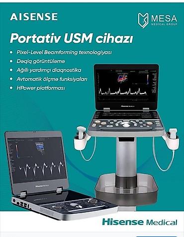 Hisense Medical USM cihazları – portativ və premium sinif ultrasəs lalafo.az -da Hisense Medical USM cihazları – portativ və premium sinif ultrasəs