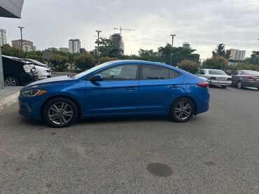 qaş laminasiyası qiyməti: Hunday Elantra günlük icareye verilir dopozit 350 azn yaş heddi 25+